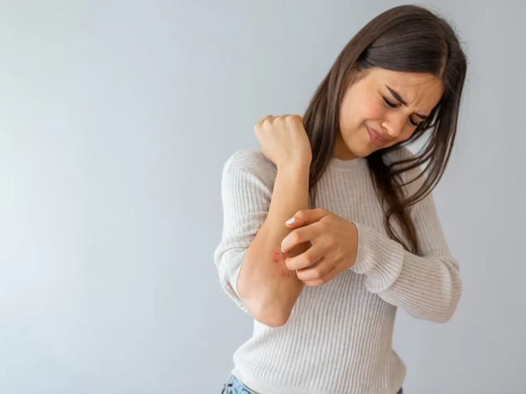 Stress Rash And Their Impacts on Heathy life And Secure Future