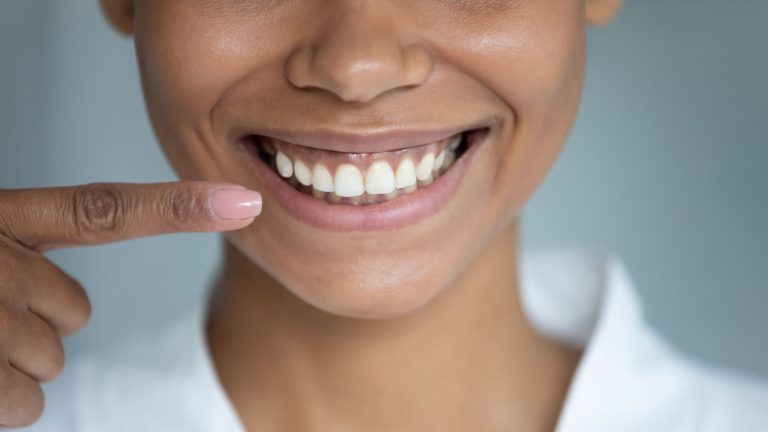 What Are The Different Gum Hyperpigmentation Treatment Options?