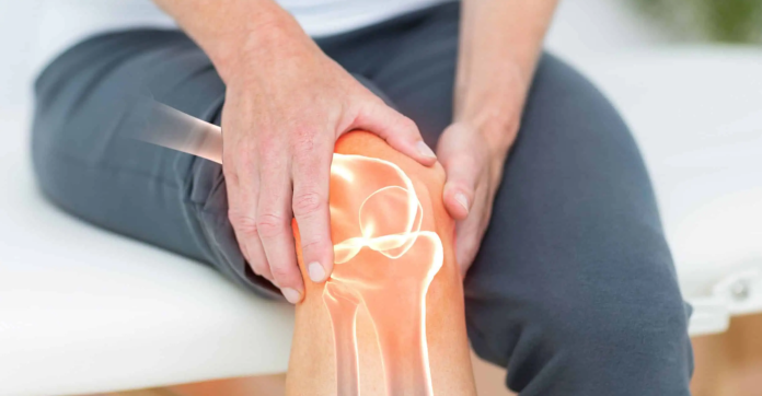Arthritis And The Role Of Joint Support Supplements In Treating It