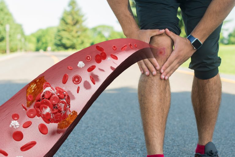 How to get the best treatment for your knee joint