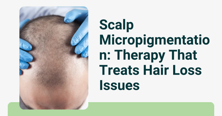 Scalp Micropigmentation: Therapy That Treats Hair Loss Issues 